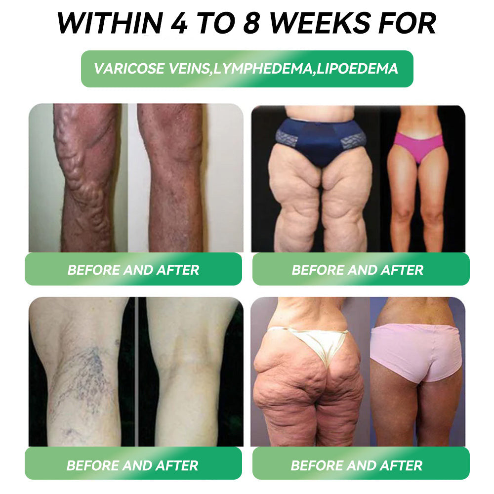 Only 10 boxes left! โฐ Grab an exclusive 30% discount now! Endocrinologists recommend 4 to 6 boxes to stabilise weight loss and prevent rebound. Last chance before the year ends! Donโt wait any longer! ๐ฅ